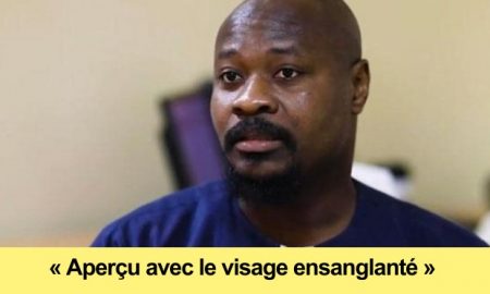 le-depute-guy-marius-sagna-agresse-incident-a-lome