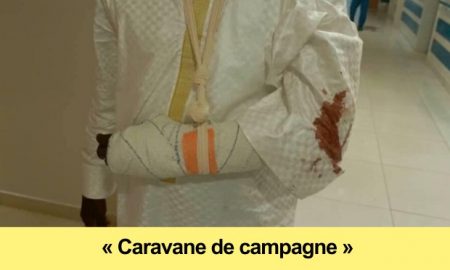 malick-gakou-gravement-blesse-attaque-du-cortege-de-sonko